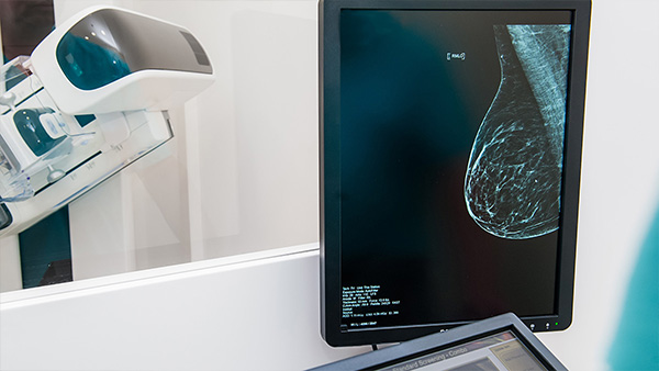aveniq-whitepaper-podcast-gesundheitswesen-mammographie-21-09-20